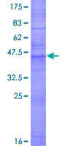Novus Biologicals Recombinant Human Claudin-5 GST (N-Term) Protein 2 &mu;g | Buy Online | Novus Biologicals&trade; | Fisher Scientific