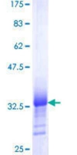 Novus Biologicals Recombinant Human TNFAIP1 GST (N-Term) Protein 25 &mu;g | Buy Online | Novus Biologicals&trade; | Fisher Scientific