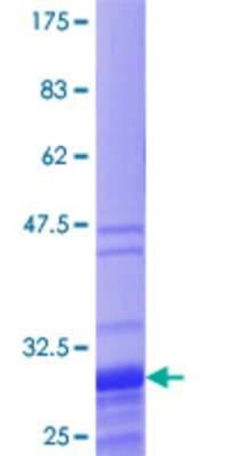 Novus Biologicals Recombinant Human TNP1 GST (N-Term) Protein 10 &mu;g | Buy Online | Novus Biologicals&trade; | Fisher Scientific