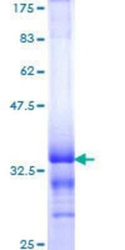 Novus Biologicals Recombinant Human Topoisomerase I GST (N-Term) Protein 25 &mu;g | Buy Online | Novus Biologicals&trade; | Fisher Scientific
