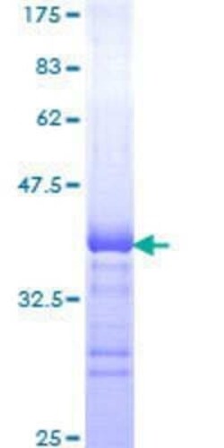 Novus Biologicals&trade;&nbsp;Recombinant Human TOP2A GST (N-Term) Protein