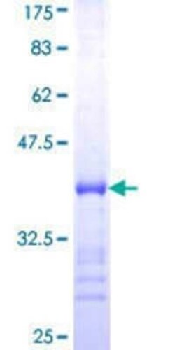 Novus Biologicals Recombinant Human 53BP2 GST (N-Term) Protein 10 &mu;g | Buy Online | Novus Biologicals&trade; | Fisher Scientific