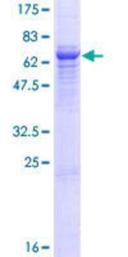 Novus Biologicals&trade;&nbsp;Recombinant Human 5T4 GST (N-Term) Protein