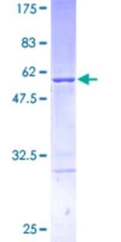 Novus Biologicals Recombinant Human TPD52 GST (N-Term) Protein 25 &mu;g | Buy Online | Novus Biologicals&trade; | Fisher Scientific
