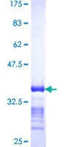Novus Biologicals Recombinant Human TPD52 GST (N-Term) Protein 25 &mu;g | Buy Online | Novus Biologicals&trade; | Fisher Scientific
