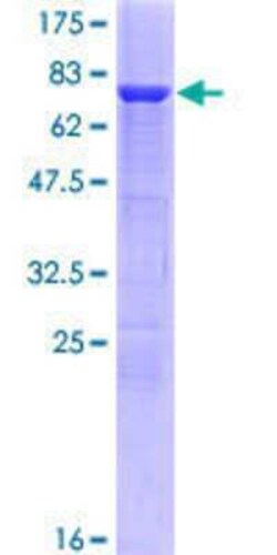 Novus Biologicals Recombinant Human Tryptophan Hydroxylase 1/TPH-1 GST (N-Term) Protein 10 &mu;g | Buy Online | Novus Biologicals&trade; | Fisher Scientific