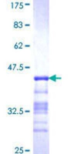 Novus Biologicals Recombinant Human TR2/NR2C1 GST (N-Term) Protein 25 &mu;g | Buy Online | Novus Biologicals&trade; | Fisher Scientific