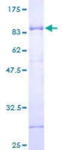 Novus Biologicals Recombinant Human TRAF-2 GST (N-Term) Protein 10 &mu;g | Buy Online | Novus Biologicals&trade; | Fisher Scientific