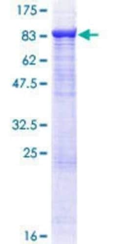 Novus Biologicals Recombinant Human TRAF-3 GST (N-Term) Protein 10 &mu;g | Buy Online | Novus Biologicals&trade; | Fisher Scientific