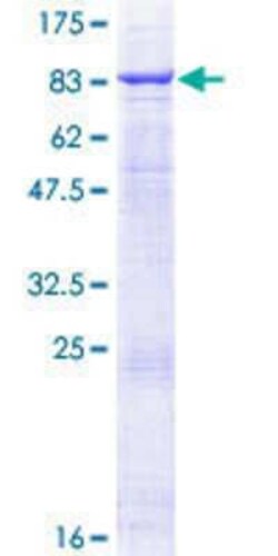 Novus Biologicals Recombinant Human TRAF-5 GST (N-Term) Protein 25 &mu;g | Buy Online | Novus Biologicals&trade; | Fisher Scientific