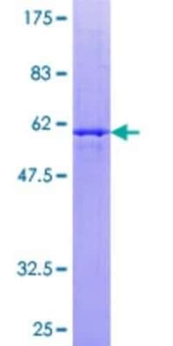 Novus Biologicals Recombinant Human Thyrotropin Releasing Hormone GST (N-Term) Protein 10 &mu;g | Buy Online | Novus Biologicals&trade; | Fisher Scientific