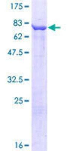Novus Biologicals Recombinant Human CCT3 GST (N-Term) Protein 10 &mu;g | Buy Online | Novus Biologicals&trade; | Fisher Scientific