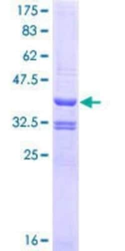 Novus Biologicals Recombinant Human TRIO GST (N-Term) Protein 25 &mu;g | Buy Online | Novus Biologicals&trade; | Fisher Scientific