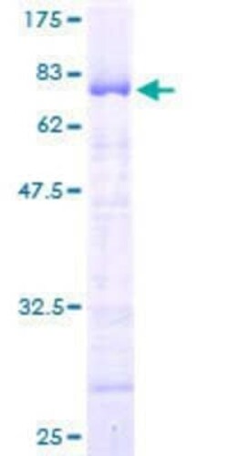 Novus Biologicals Recombinant Human TRIP6 GST (N-Term) Protein 25 &mu;g | Buy Online | Novus Biologicals&trade; | Fisher Scientific