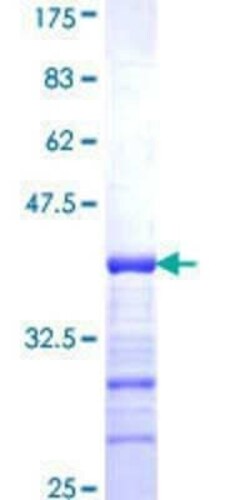 Novus Biologicals Recombinant Human TRIP6 GST (N-Term) Protein 25 &mu;g | Buy Online | Novus Biologicals&trade; | Fisher Scientific