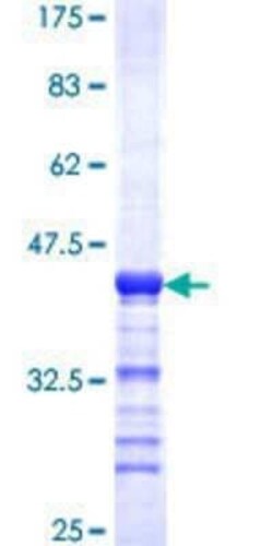 Novus Biologicals Recombinant Human TRIP6 GST (N-Term) Protein 10 &mu;g | Buy Online | Novus Biologicals&trade; | Fisher Scientific