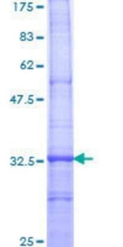 Novus Biologicals Recombinant Human TRPC1 GST (N-Term) Protein 10 &mu;g | Buy Online | Novus Biologicals&trade; | Fisher Scientific