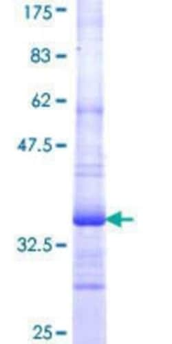 Novus Biologicals Recombinant Human TRPC5 GST (N-Term) Protein 10 &mu;g | Buy Online | Novus Biologicals&trade; | Fisher Scientific