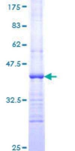 Novus Biologicals Recombinant Human TSC1 GST (N-Term) Protein 10 &mu;g | Buy Online | Novus Biologicals&trade; | Fisher Scientific