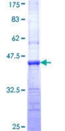 Novus Biologicals Recombinant Human TSC2 GST (N-Term) Protein 25 &mu;g | Buy Online | Novus Biologicals&trade; | Fisher Scientific