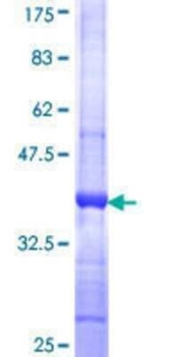 Novus Biologicals Recombinant Human TSPY1 GST (N-Term) Protein 10 &mu;g | Buy Online | Novus Biologicals&trade; | Fisher Scientific