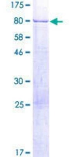 Novus Biologicals Recombinant Human TSPYL1 GST (N-Term) Protein 2 &mu;g | Buy Online | Novus Biologicals&trade; | Fisher Scientific