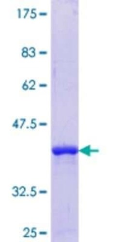 Novus Biologicals Recombinant Human TSPYL1 GST (N-Term) Protein 25 &mu;g | Buy Online | Novus Biologicals&trade; | Fisher Scientific