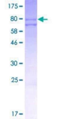 Novus Biologicals Recombinant Human DNAJC7 GST (N-Term) Protein 10 &mu;g | Buy Online | Novus Biologicals&trade; | Fisher Scientific