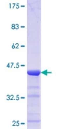 Novus Biologicals Recombinant Human TTC4 GST (N-Term) Protein 10 &mu;g | Buy Online | Novus Biologicals&trade; | Fisher Scientific