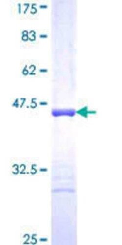 Novus Biologicals Recombinant Human Titin GST (N-Term) Protein 25 &mu;g | Buy Online | Novus Biologicals&trade; | Fisher Scientific