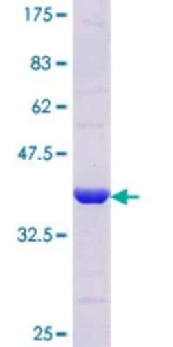 Novus Biologicals Recombinant Human Alpha-TTP GST (N-Term) Protein 25 &mu;g | Buy Online | Novus Biologicals&trade; | Fisher Scientific