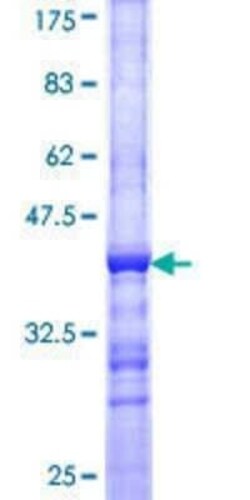 Novus Biologicals Recombinant Human Tubby GST (N-Term) Protein 25 &mu;g | Buy Online | Novus Biologicals&trade; | Fisher Scientific