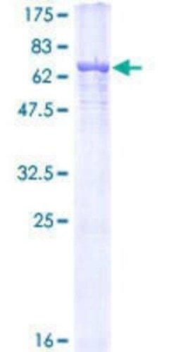 Novus Biologicals Recombinant Human alpha Tubulin 3c GST (N-Term) Protein 25 &mu;g | Buy Online | Novus Biologicals&trade; | Fisher Scientific
