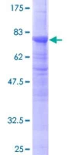 Novus Biologicals Recombinant Human beta II Tubulin A GST (N-Term) Protein 10 &mu;g | Buy Online | Novus Biologicals&trade; | Fisher Scientific