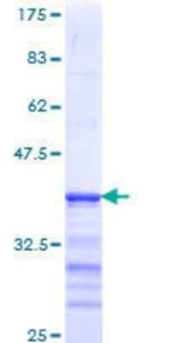Novus Biologicals Recombinant Human beta II Tubulin A GST (N-Term) Protein 10 &mu;g | Buy Online | Novus Biologicals&trade; | Fisher Scientific