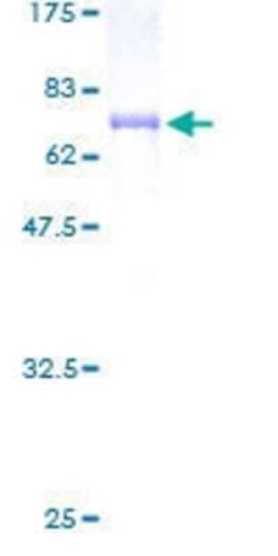 Novus Biologicals Recombinant Human Tuftelin 1 GST (N-Term) Protein 2 &mu;g | Buy Online | Novus Biologicals&trade; | Fisher Scientific