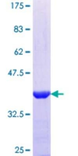 Novus Biologicals Recombinant Human Tuftelin 1 GST (N-Term) Protein 10 &mu;g | Buy Online | Novus Biologicals&trade; | Fisher Scientific