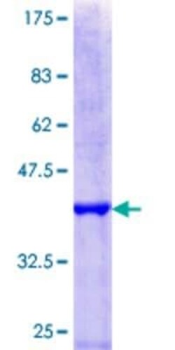 Novus Biologicals Recombinant Human HIRA GST (N-Term) Protein 25 &mu;g | Buy Online | Novus Biologicals&trade; | Fisher Scientific