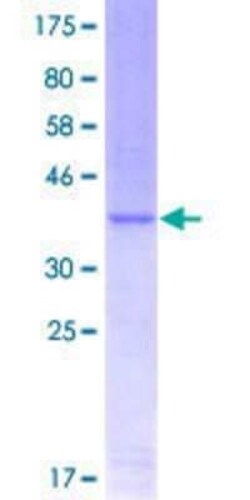 Novus Biologicals Recombinant Human Twist-1 GST (N-Term) Protein 10 &mu;g | Buy Online | Novus Biologicals&trade; | Fisher Scientific