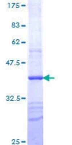 Novus Biologicals Recombinant Human RLK/TXK GST (N-Term) Protein 25 &mu;g | Buy Online | Novus Biologicals&trade; | Fisher Scientific