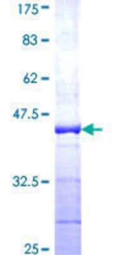 Novus Biologicals Recombinant Human UBA52 GST (N-Term) Protein 25 &mu;g | Buy Online | Novus Biologicals&trade; | Fisher Scientific