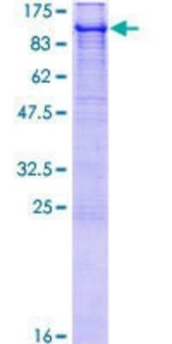 Novus Biologicals Recombinant Human E6AP/UBE3A GST (N-Term) Protein 10 &mu;g | Buy Online | Novus Biologicals&trade; | Fisher Scientific