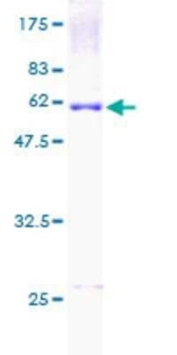Novus Biologicals Recombinant Human UCP2 GST (N-Term) Protein 2 &mu;g | Buy Online | Novus Biologicals&trade; | Fisher Scientific