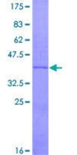 Novus Biologicals Recombinant Human UCP3 GST (N-Term) Protein 10 &mu;g | Buy Online | Novus Biologicals&trade; | Fisher Scientific