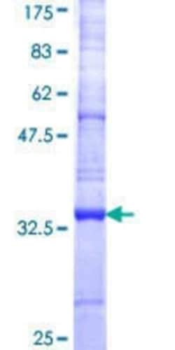 Novus Biologicals Recombinant Human UGT GST (N-Term) Protein 10 &mu;g | Buy Online | Novus Biologicals&trade; | Fisher Scientific