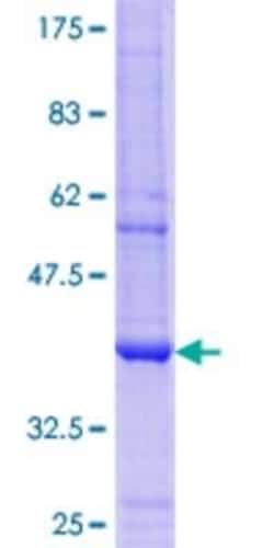 Novus Biologicals Recombinant Human UGT2B4 GST (N-Term) Protein 10 &mu;g | Buy Online | Novus Biologicals&trade; | Fisher Scientific
