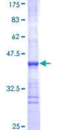 Novus Biologicals Recombinant Human UGT2B10 GST (N-Term) Protein 25 &mu;g | Buy Online | Novus Biologicals&trade; | Fisher Scientific