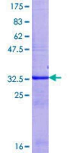 Novus Biologicals Recombinant Human UGT2B15 GST (N-Term) Protein 25 &mu;g | Buy Online | Novus Biologicals&trade; | Fisher Scientific