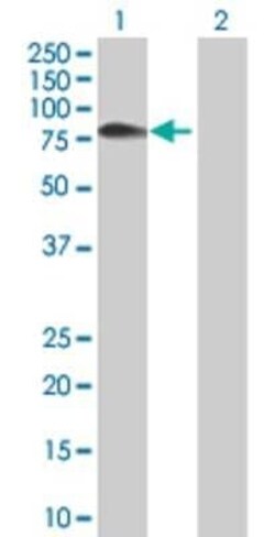 Novus Biologicals Uromodulin 293T Cell Transient Overexpression Lysate 0.1 mL | Buy Online | Novus Biologicals&trade; | Fisher Scientific