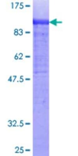 Novus Biologicals Recombinant Human COL14A1 GST (N-Term) Protein 10 &mu;g | Buy Online | Novus Biologicals&trade; | Fisher Scientific